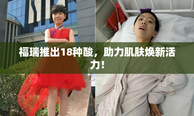 福瑞推出18种酸，助力肌肤焕新活力！