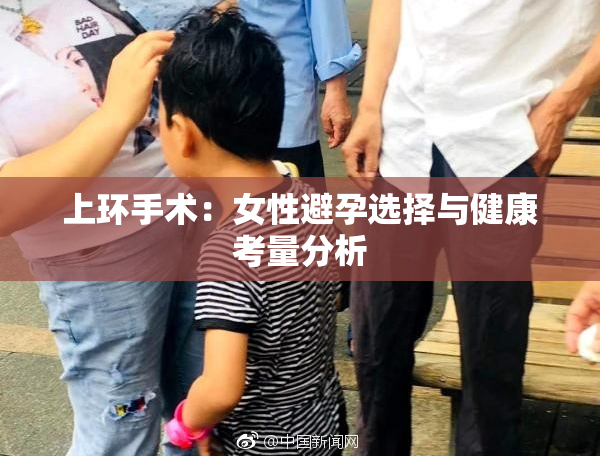上环手术：女性避孕选择与健康考量分析