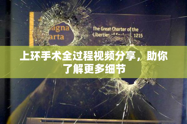 上环手术全过程视频分享，助你了解更多细节