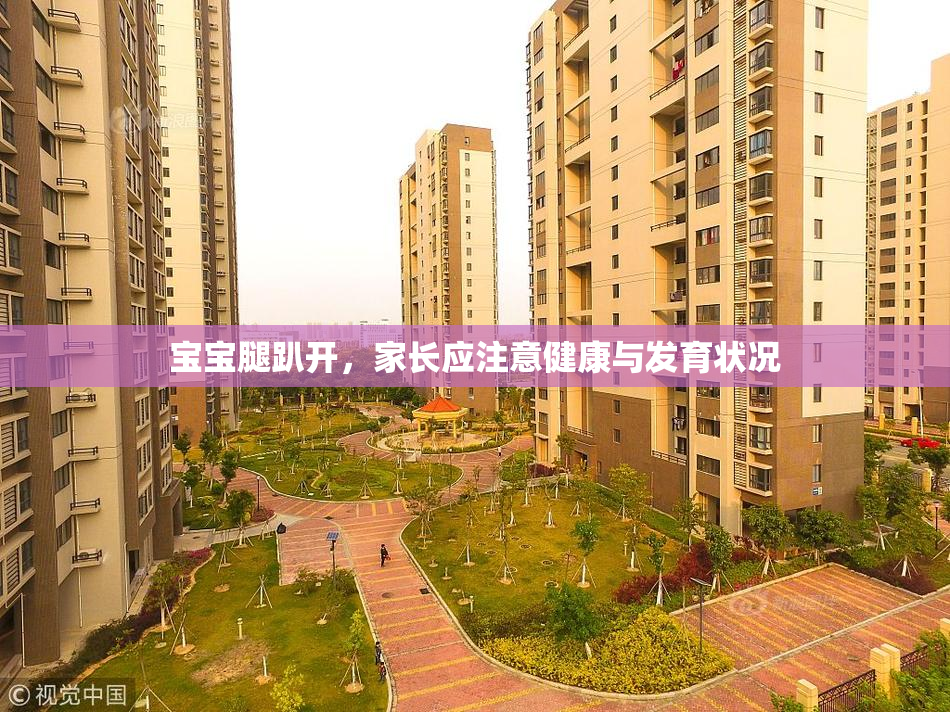 宝宝腿趴开，家长应注意健康与发育状况