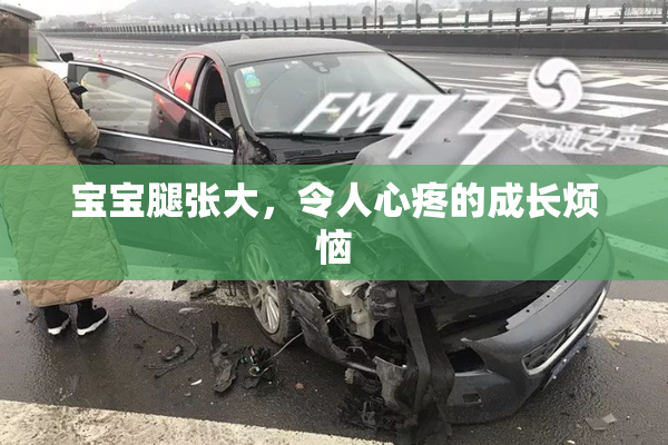 宝宝腿张大，令人心疼的成长烦恼