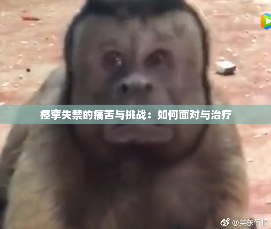 痉挛失禁的痛苦与挑战：如何面对与治疗