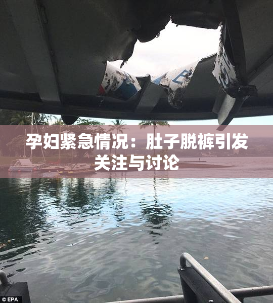孕妇紧急情况：肚子脱裤引发关注与讨论
