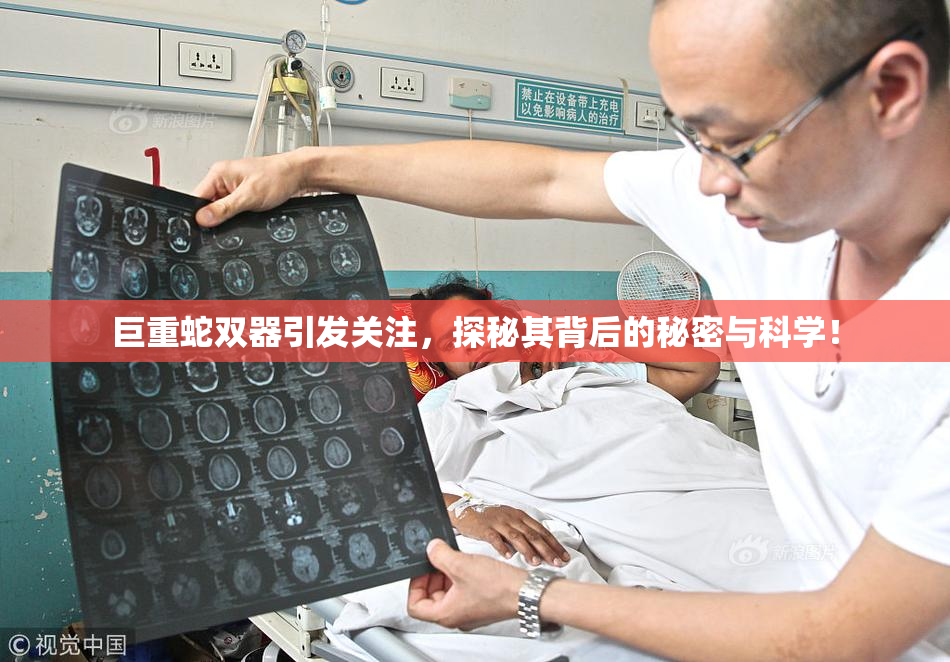 巨重蛇双器引发关注，探秘其背后的秘密与科学！