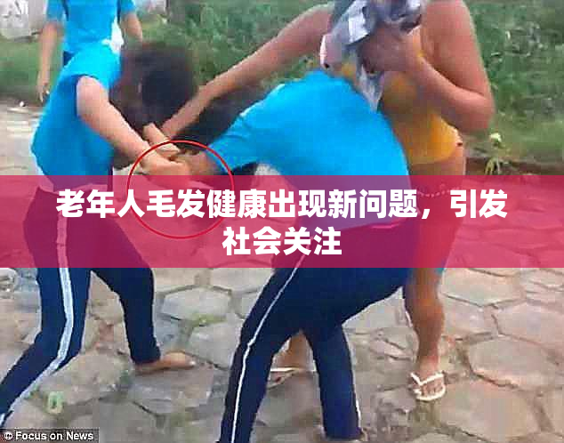 老年人毛发健康出现新问题，引发社会关注