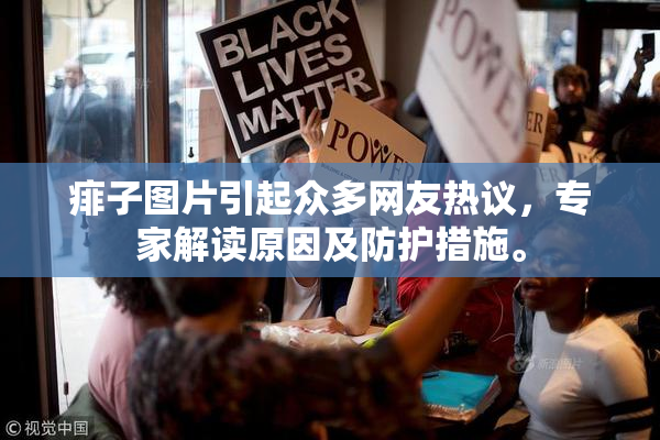 痱子图片引起众多网友热议，专家解读原因及防护措施。