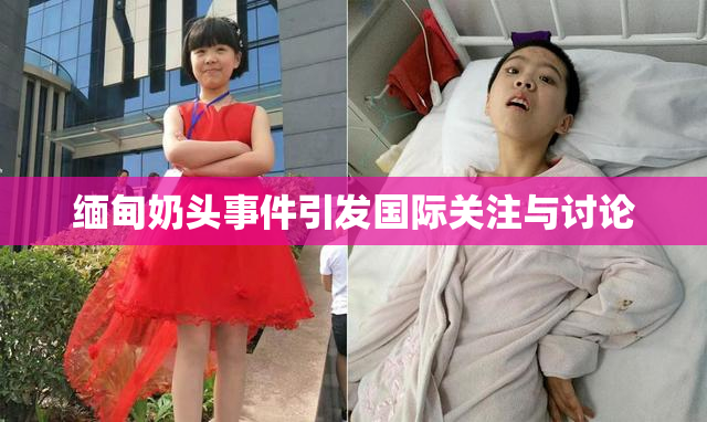 缅甸奶头事件引发国际关注与讨论