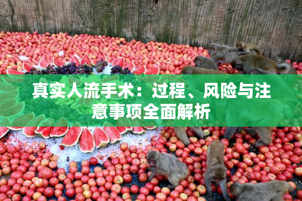 真实人流手术：过程、风险与注意事项全面解析