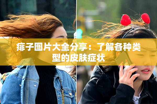 痱子图片大全分享：了解各种类型的皮肤症状