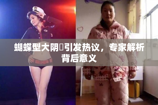 蝴蝶型大阴脣引发热议，专家解析背后意义